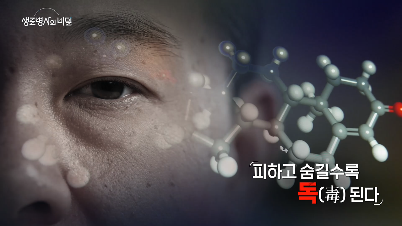 생로병사의 비밀 남성갱년기