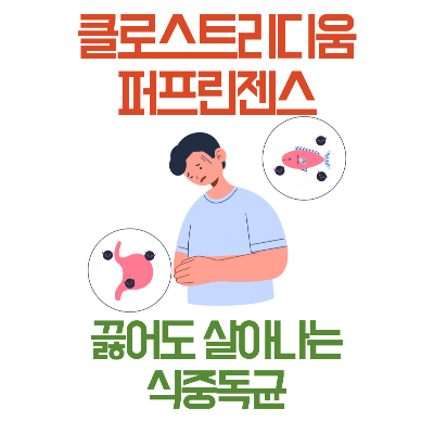 클로스트리디움 퍼프린젠스