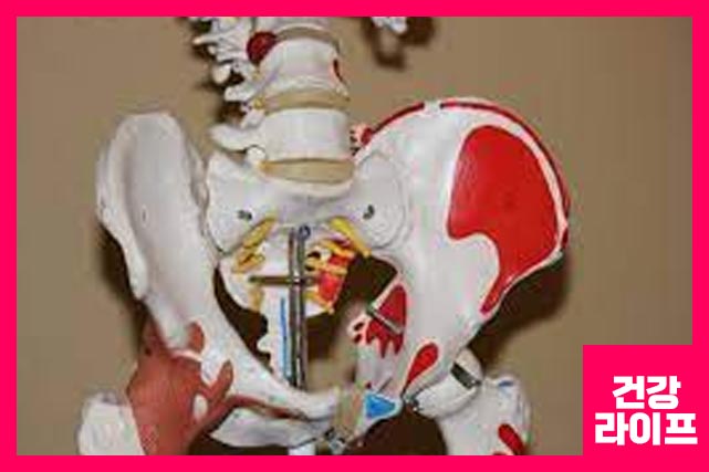 고관절 통증 치료법 5가지