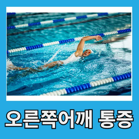 "오른쪽 어깨 통증 흔한 문제"