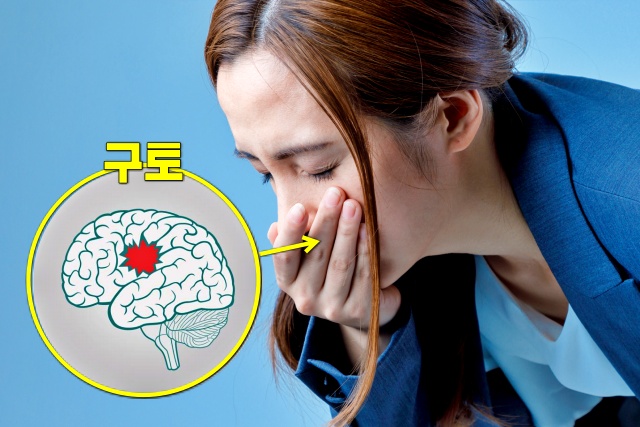 구토 어지럼증 뇌진탕 초기증상, 뇌진탕 증상, 건강 팁줌 매일꿀정보