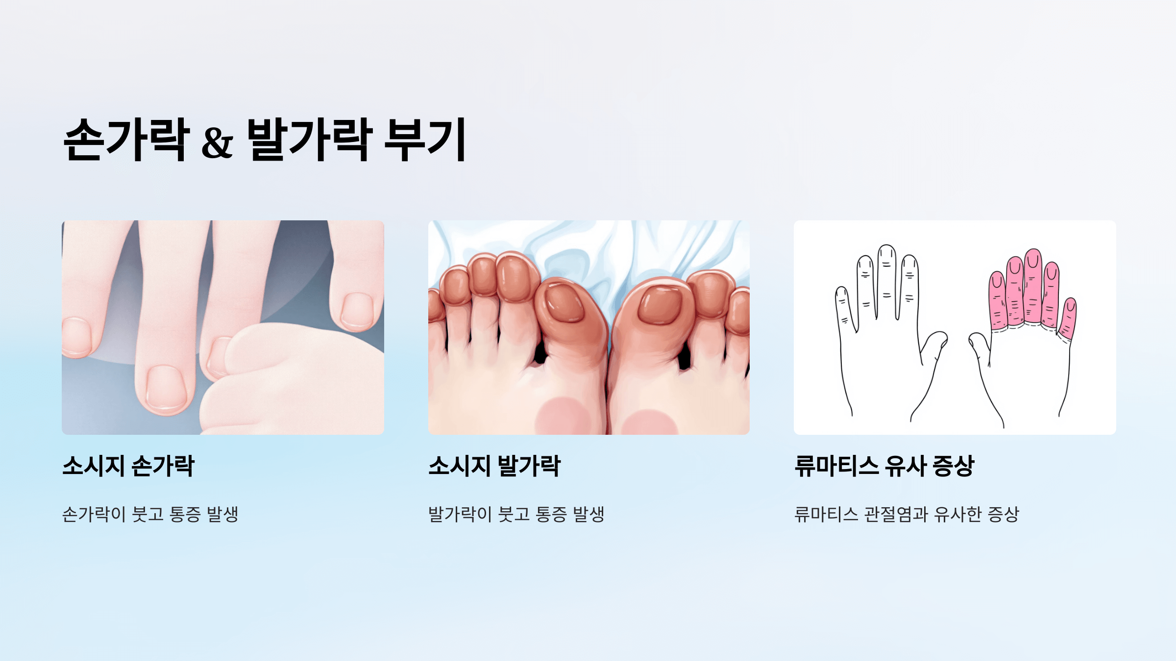 강직성 척추염과 관련된 사진입니다.