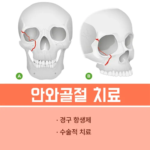 안와골절 수술후 회복기간