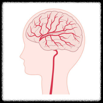 겨울철 두통, 단순감기 중장년층 뇌동맥류 경고
