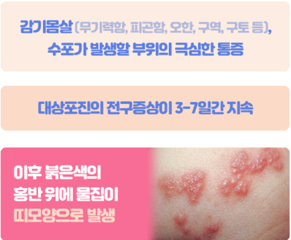 대상포진증상