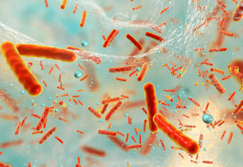 독성 쇼크 증후군