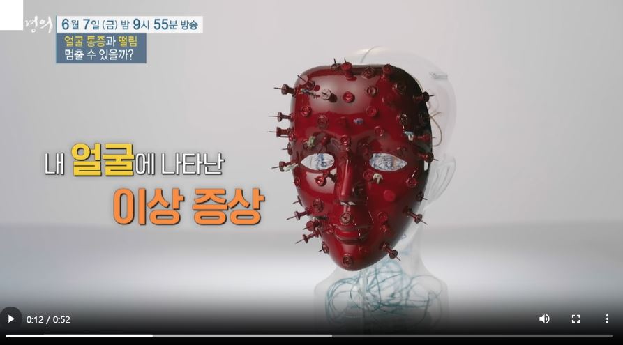 EBS 명의 삼차신경통 원인 증상 치료