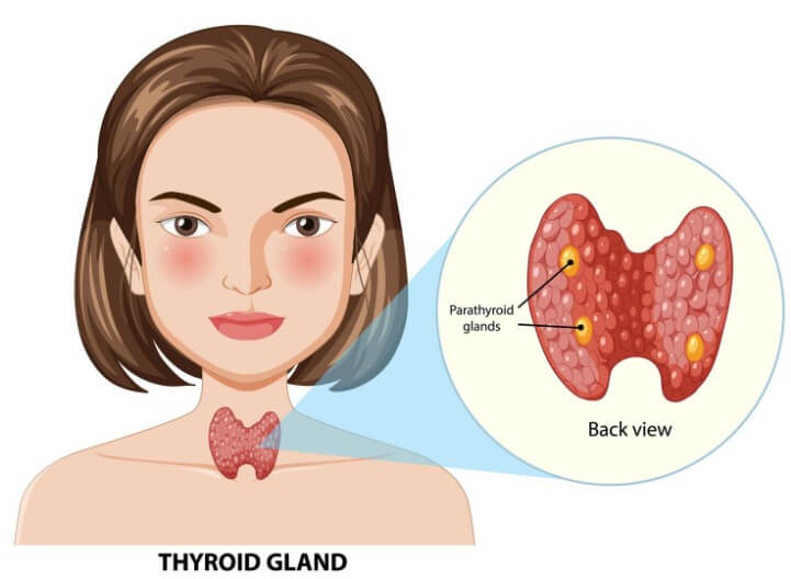 갑상선암 초기증상
