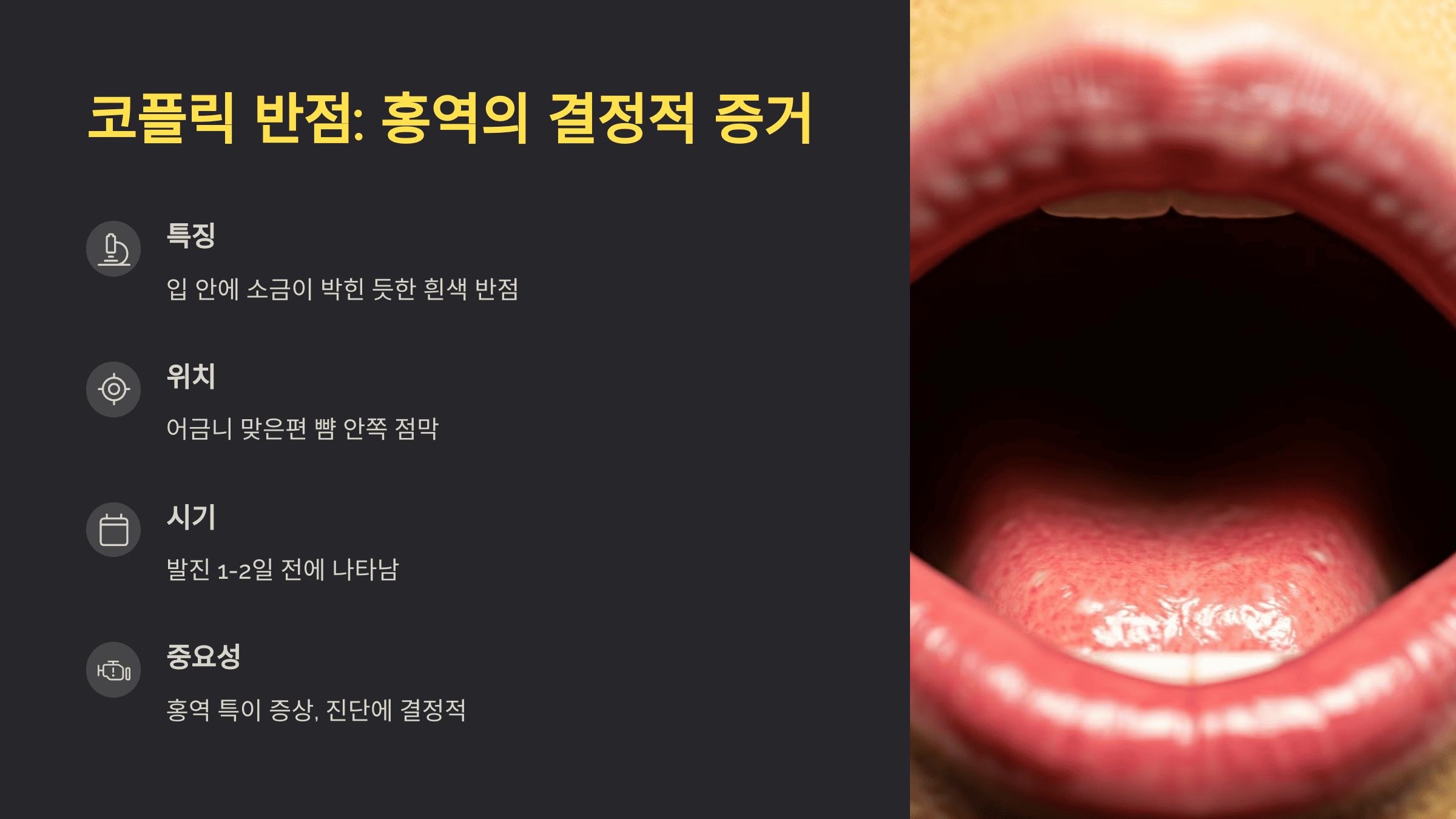 베트남 홍역 증상