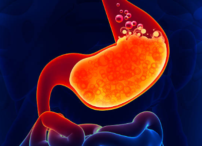 역류성 식도염에 좋은 음식