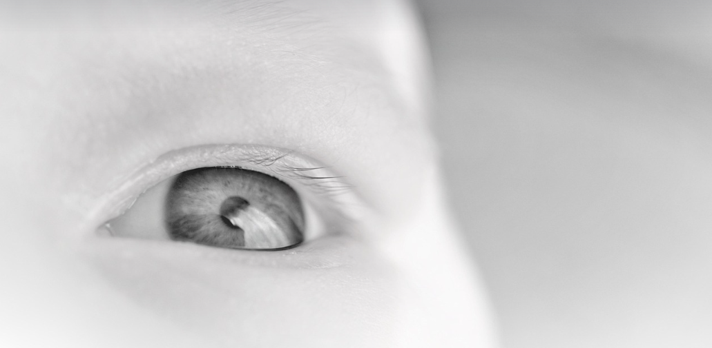 안구, 안구건조증 이미지