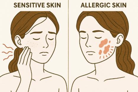 민감성피부vs알러지성피부 비교 이미지