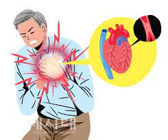 심근경색 초기증상 6가지