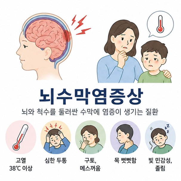뇌와 뇌를 둘러싼 막을 이용해 뇌수막염에서 염증이 발생하는 위치와 주요 증상을 소개하는 그림