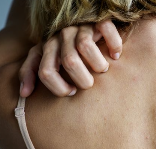 피부가려움증의 원인 9가지 총정리 섬네일