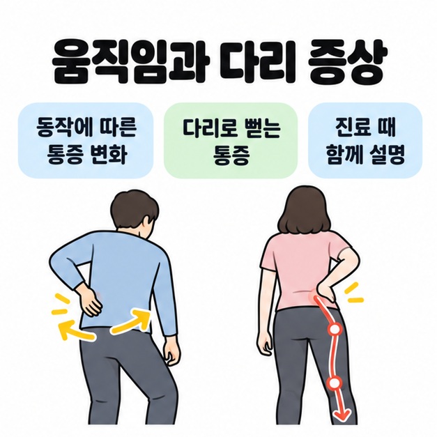 허리 움직임을 나타내는 화살표와 엉덩이에서 한쪽 다리로 내려가는 통증 경로를 두 인물의 뒷모습으로 보여주고 진료 때 함께 설명하도록 안내한 도식