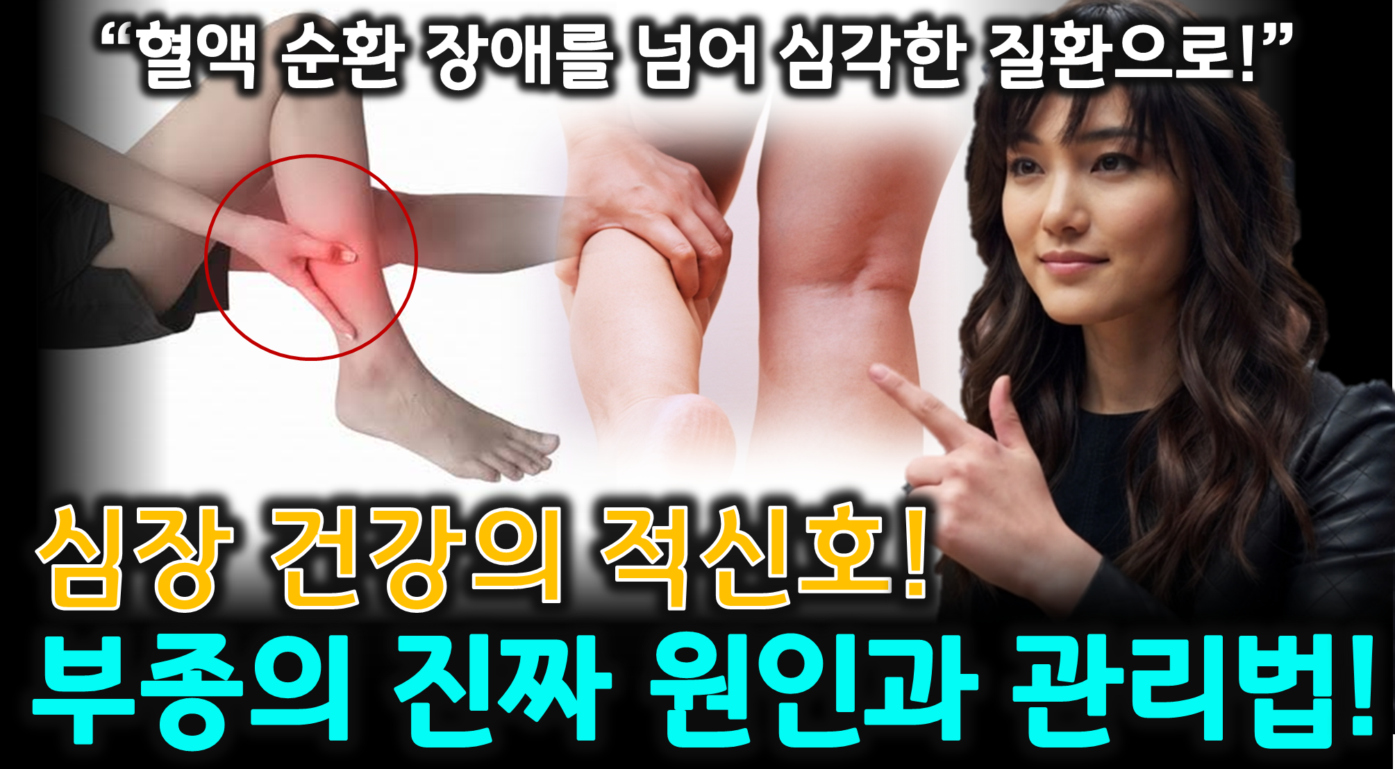 다리 붓기 원인 (심부전, 심부정맥 혈전증, 부종 관리)