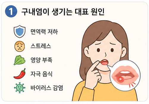 구내염이 생기는 대표 원인