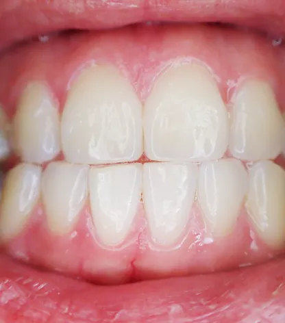 잇몸이-붓고-아플때-이유-해결방법-건강