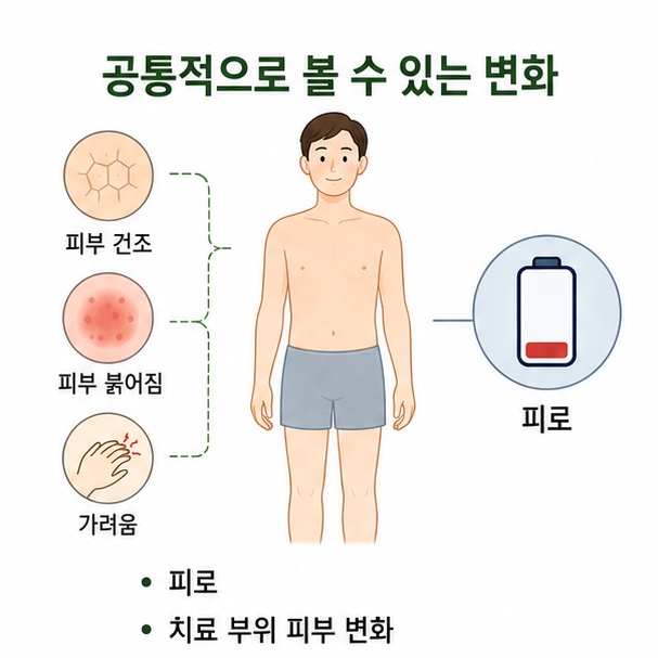 피로와 치료 부위의 건조함·붉어짐·가려움 등 방사선치료의 공통적인 변화를 표현한 이미지