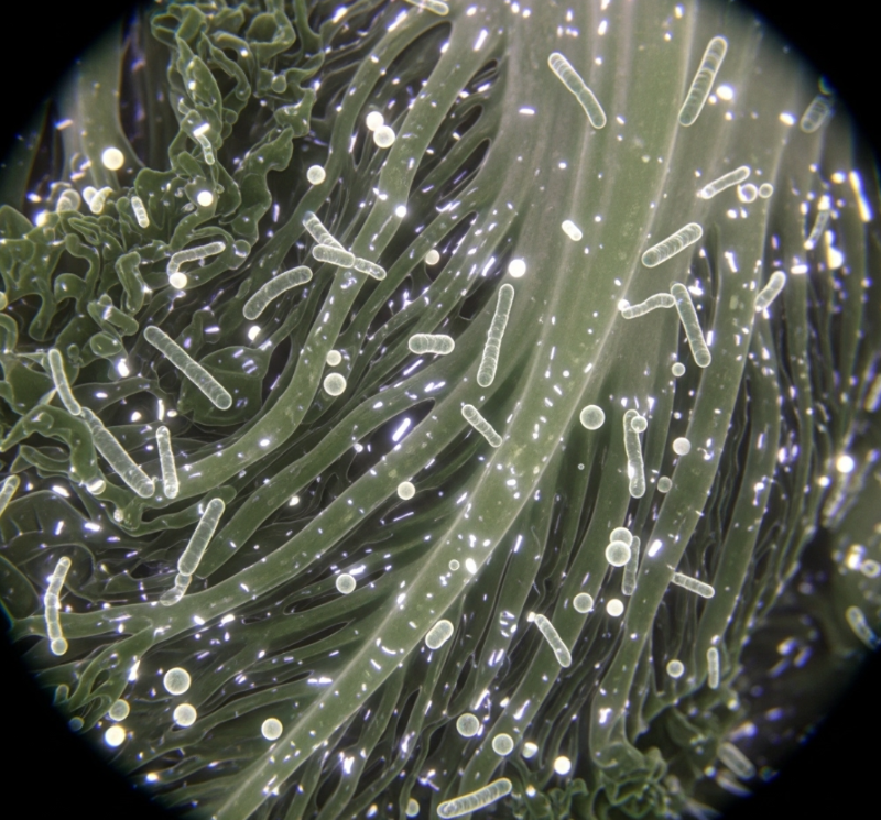 장 건강이 전신 건강의 열쇠인 이유