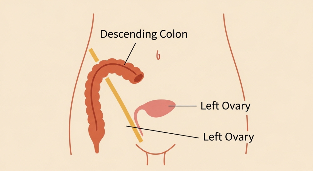 여자 왼쪽 아랫배 콕콕 통증