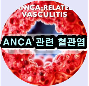 ANCA 관련 혈관염,자가면역질환,혈관염 증상,면역억제제,혈액검사,스테로이드 치료,신장 기능,폐 질환,재발 방지,치료 비용