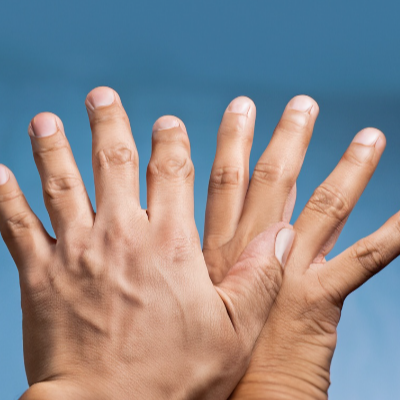 2. 손 습진 없애는 법: 무엇을 해야할까?