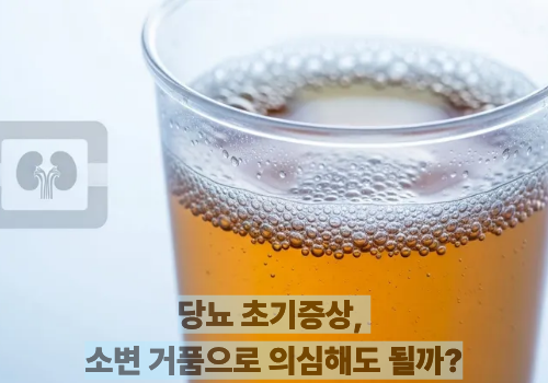 당뇨 초기증상, 소변 거품으로 의심해도 될까?