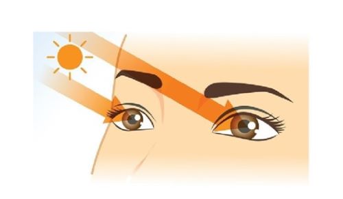 자외선으로 인한 안질환 일러스트 이미지
