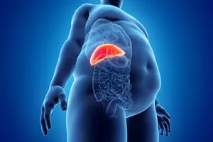 내장지방-빼는법