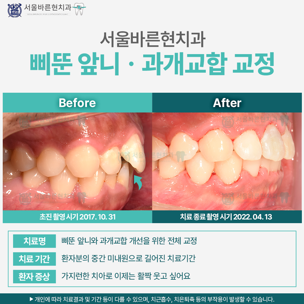 해운대 교정치과