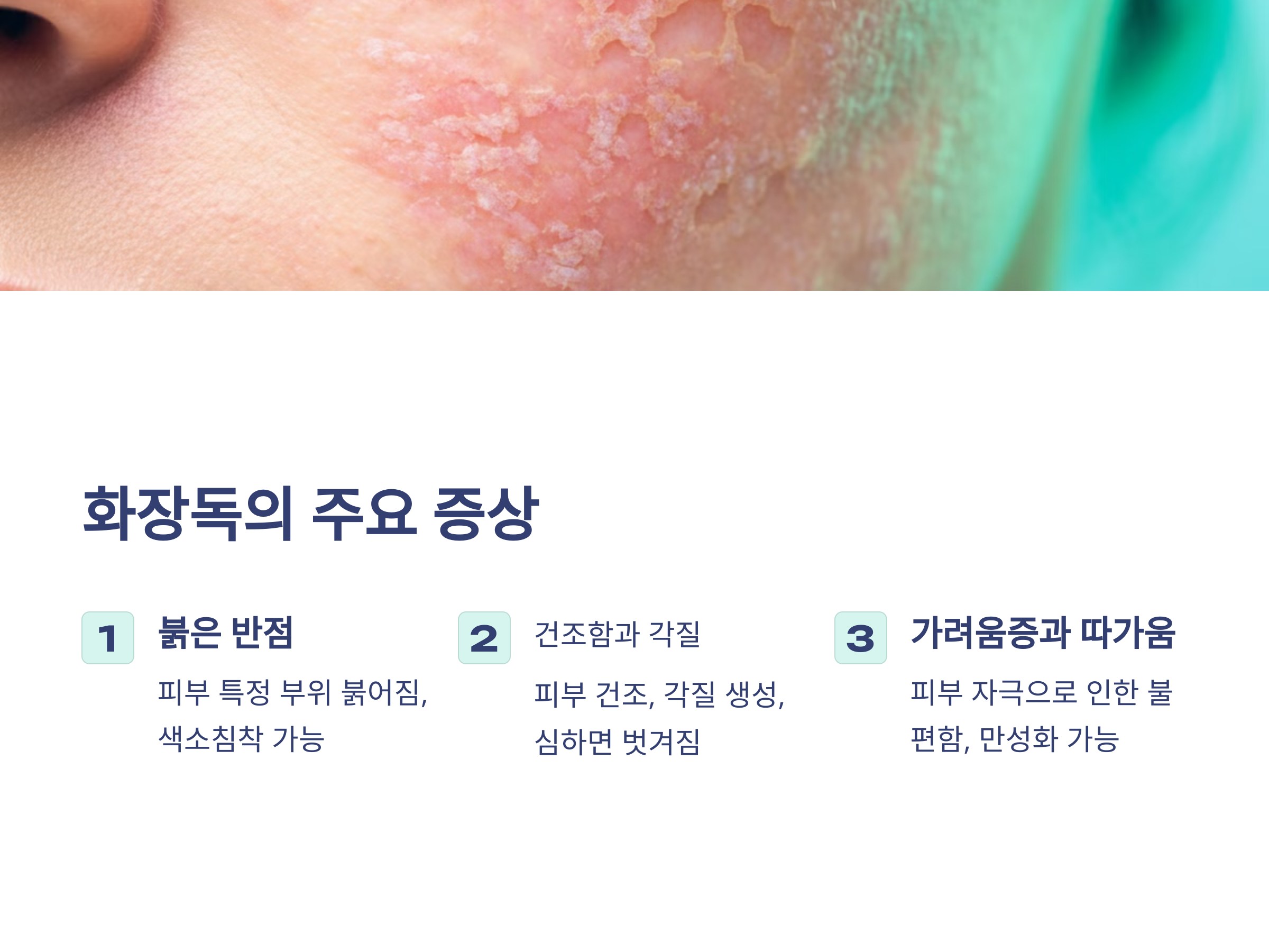 피부를 괴롭히는 화장독, 당신도 겪고 있나요?