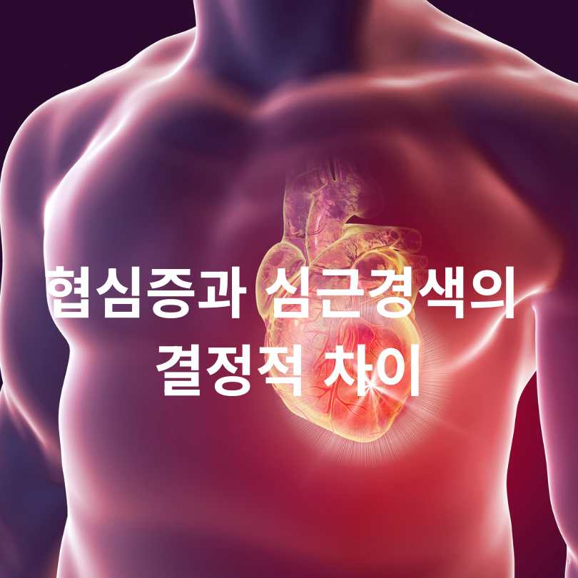 협심증과 심근경색의 결정적 차이