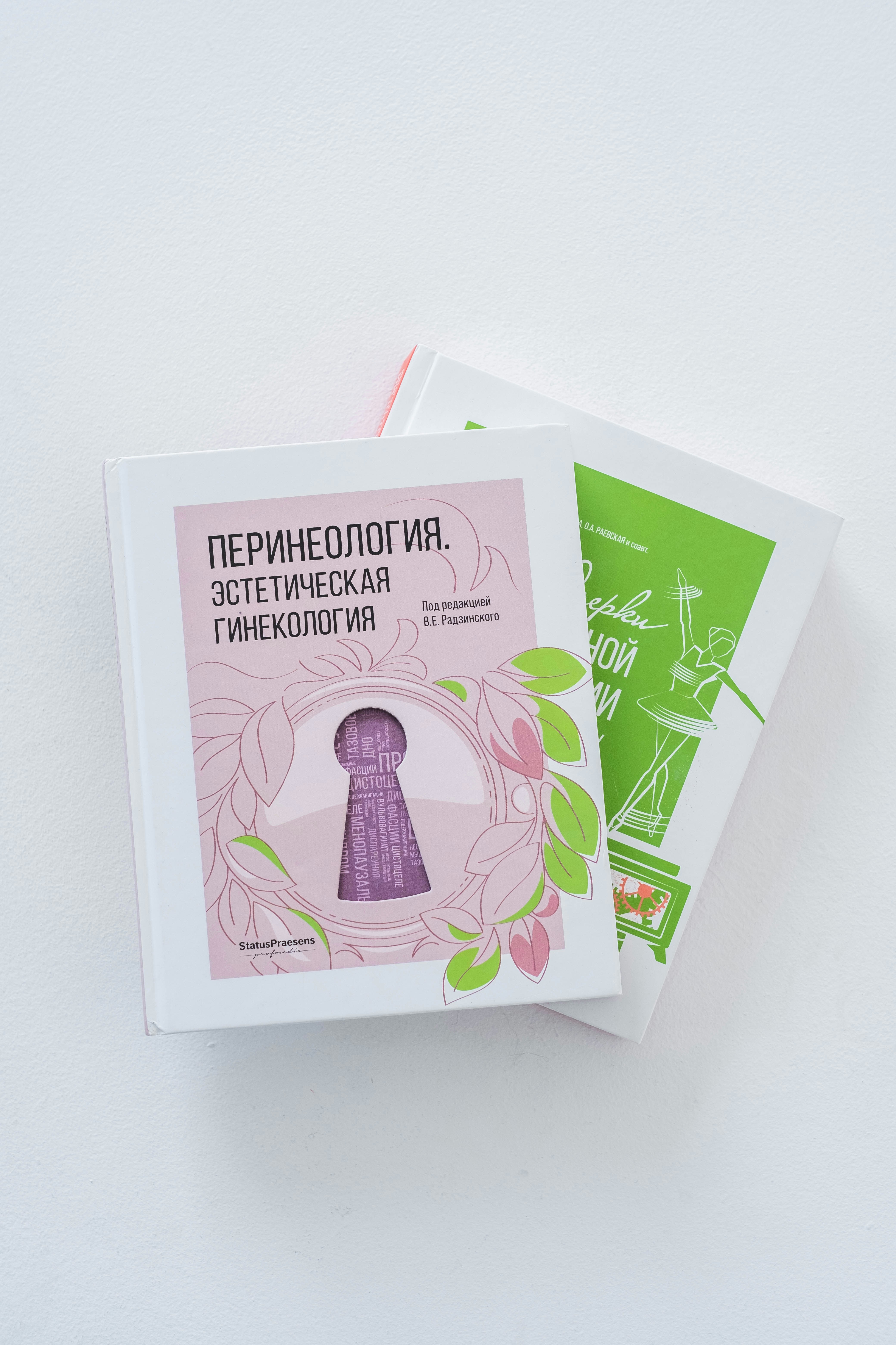 다낭성 난소 증후군