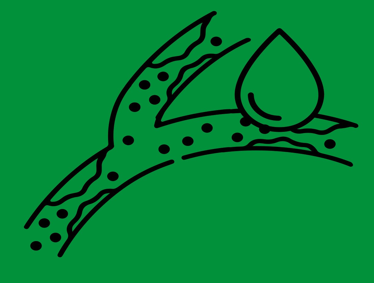 혈관 이미지 사진