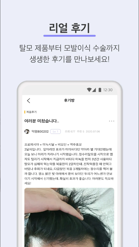 머리바바, 탈모 진단 & 커뮤니티