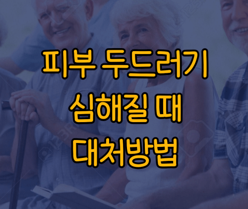 피부 두드러기 심해질 때 대처방법