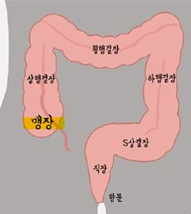 맹장