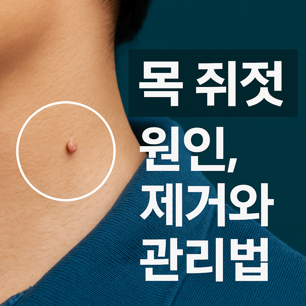 목 쥐젖 원인, 제거와 관리법