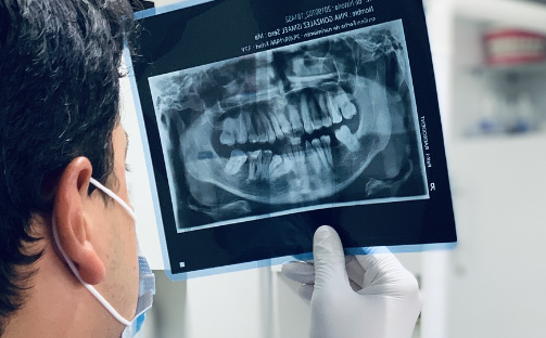 안동 임플란트 가격 싼곳 추천 비교