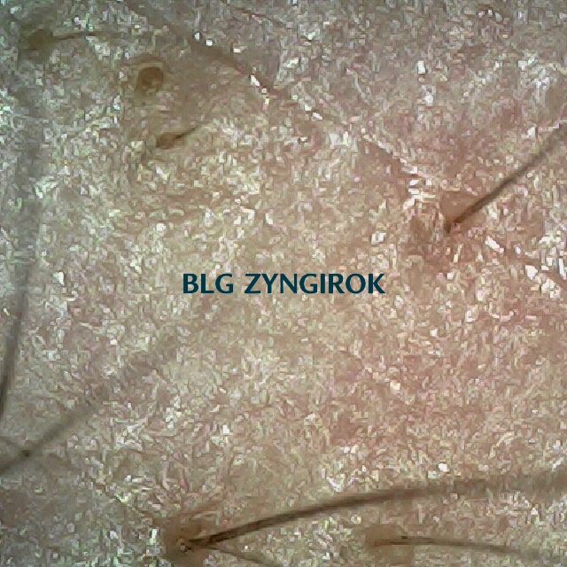 탈모 극복 프로젝트 - 오른쪽 M자 부위 두피 모습이다.