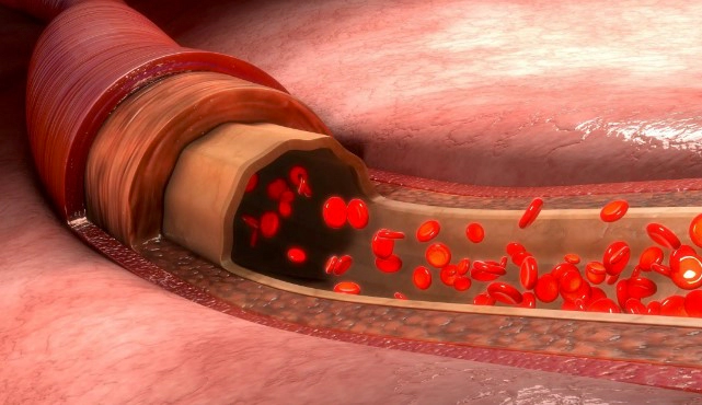 귀 혈액순환 잘 안되는 원인