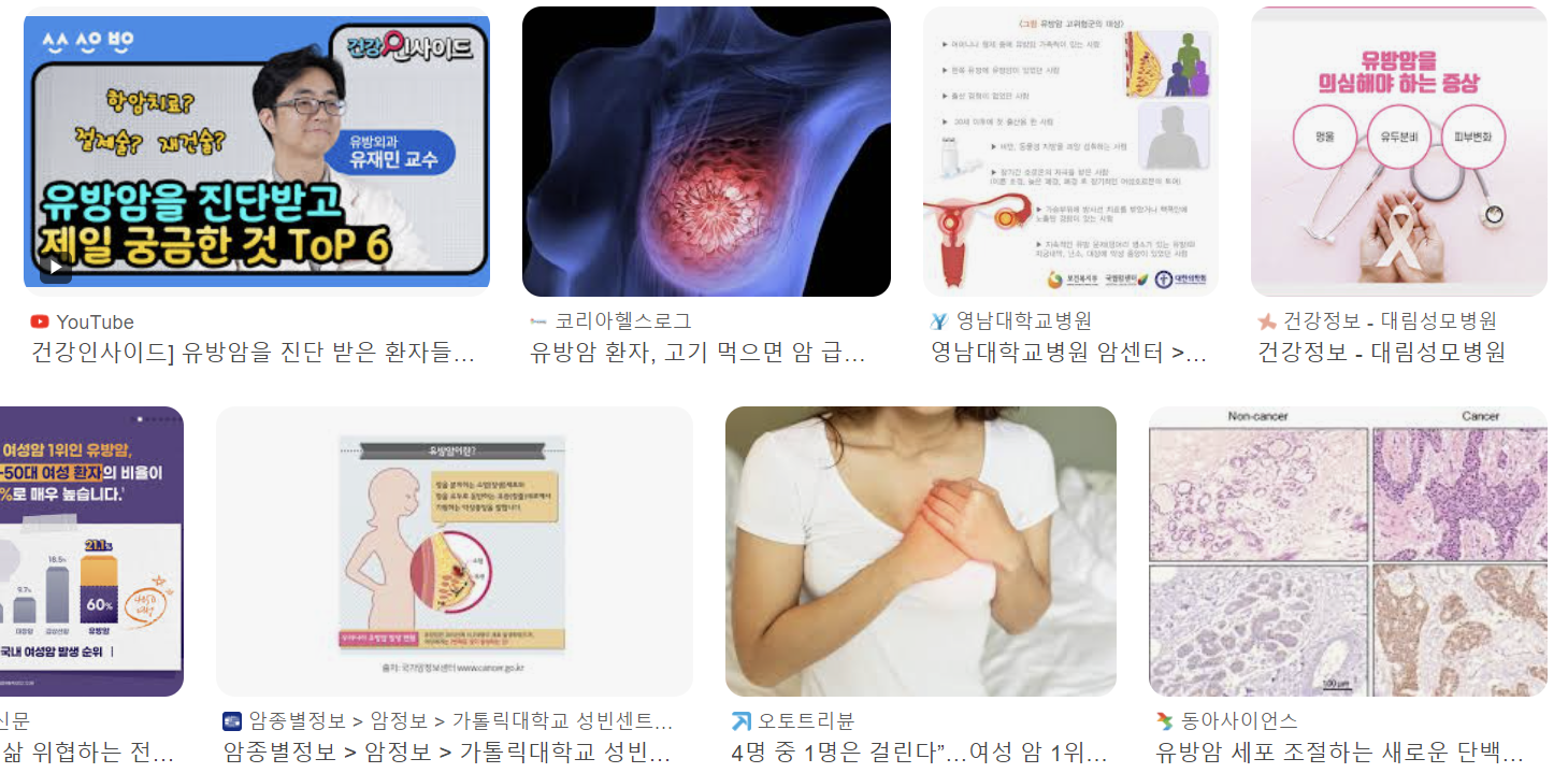 유방암 초기증상 2