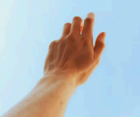 방아쇠 수지 증후군 치료