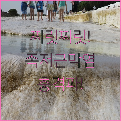 발바닥 찌릿한 통증 족저근막염 체외충..