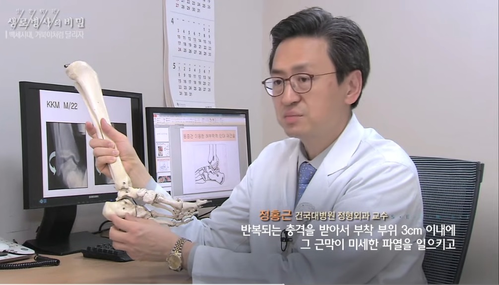 정형외과-명의-최기원-교수