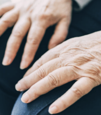 류마티스 관절염 초기증상