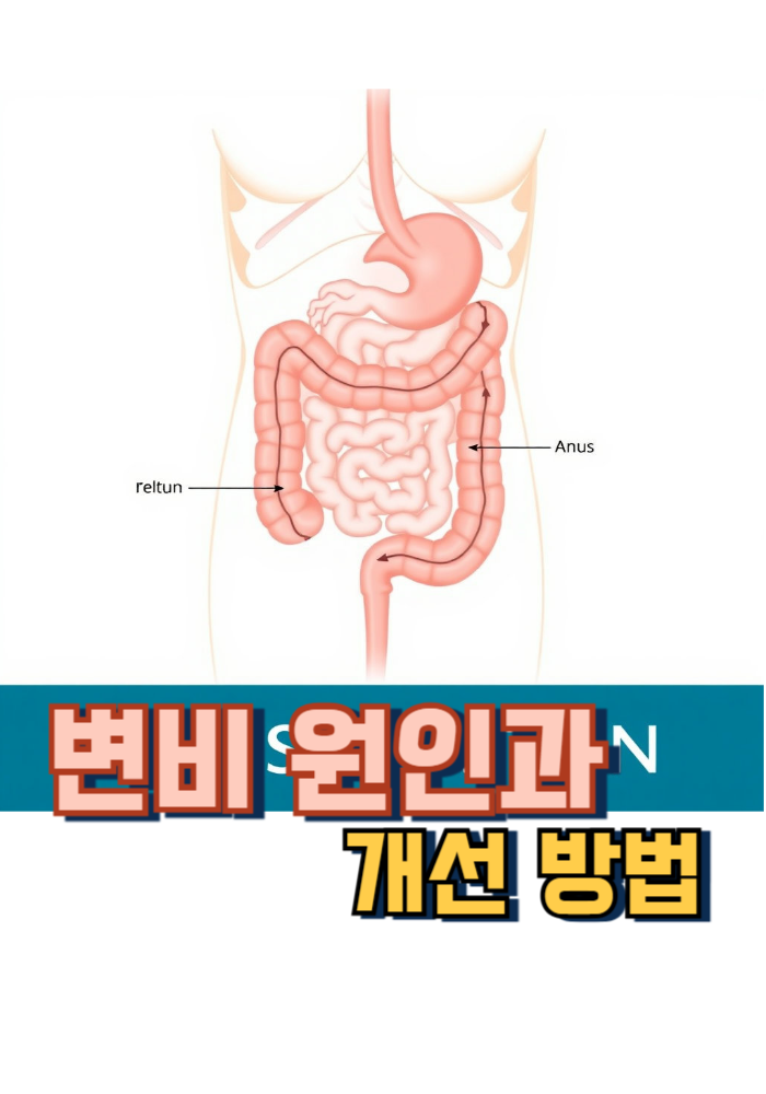 1.변비 원인과 개선 방법