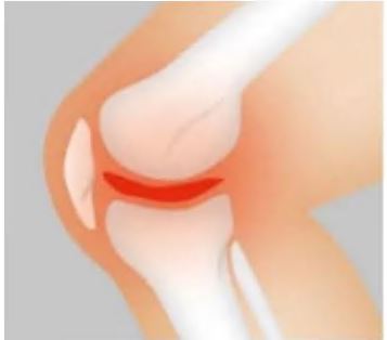 콘드로이친-가격